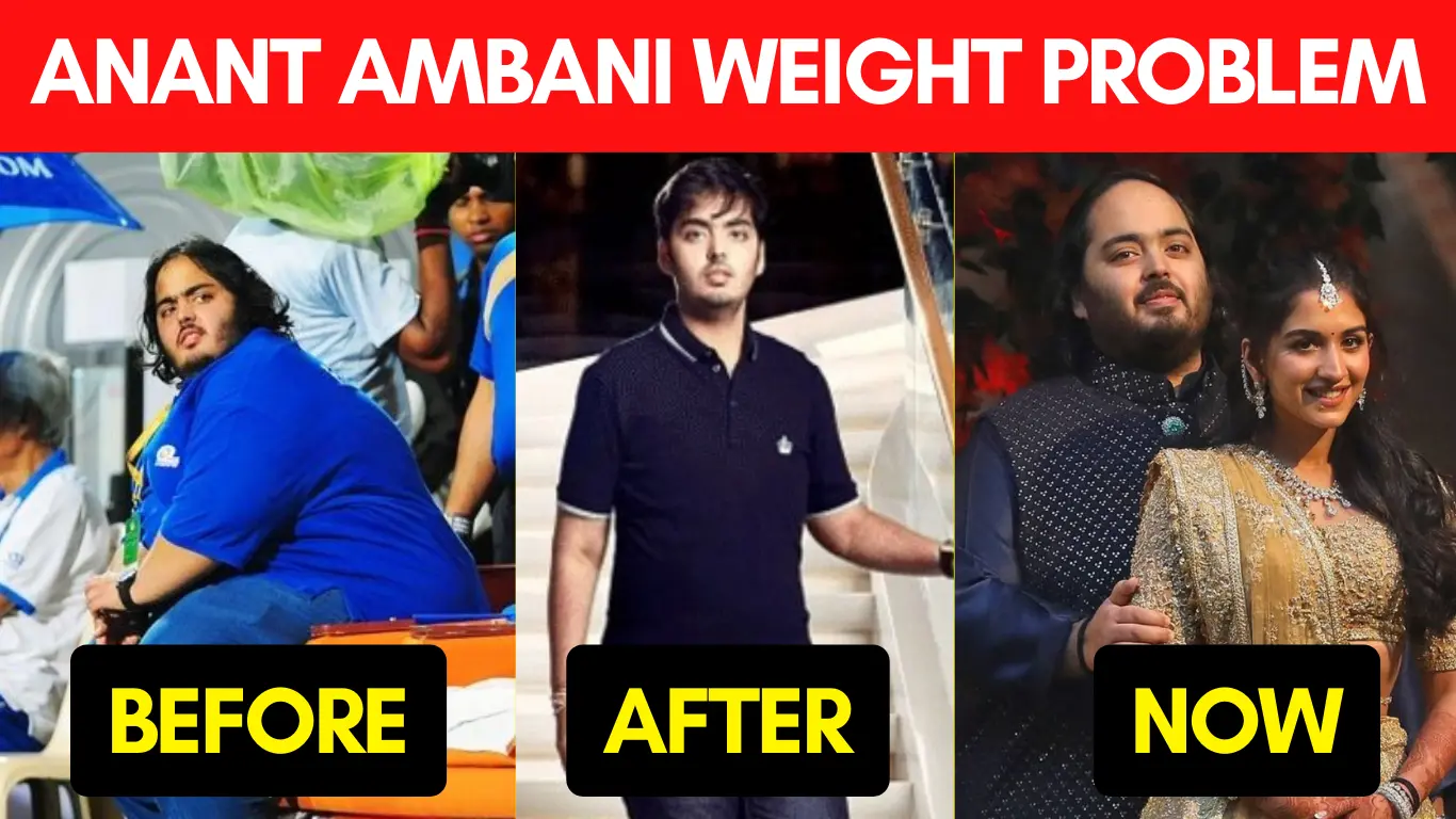 Anant Ambani Weight Gain